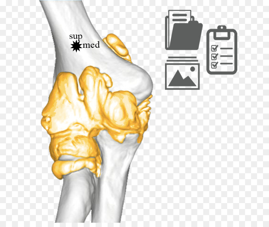 Pulgar，El Nervio Cubital PNG