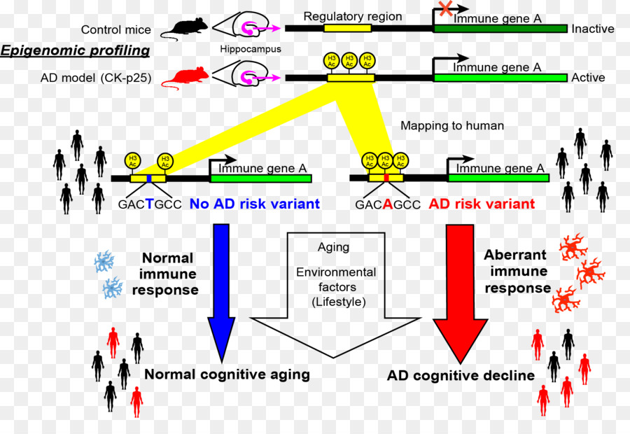 La Enfermedad De Alzheimer，Amiloide PNG