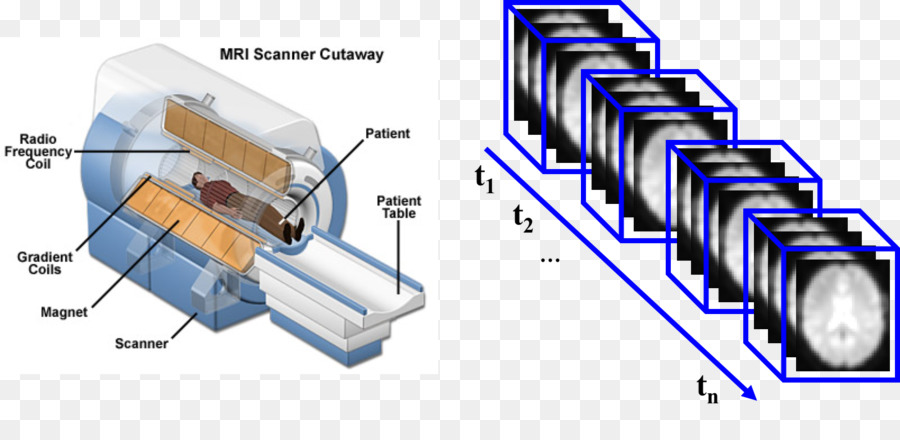 Escáner De Resonancia Magnética，Escáner PNG