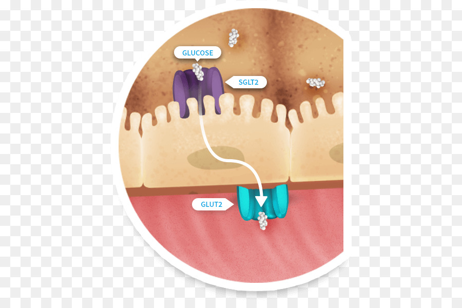 Dapagliflozin，Diabetes Mellitus Tipo 2 PNG