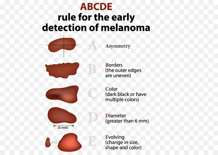 Detección De Melanoma，Piel PNG