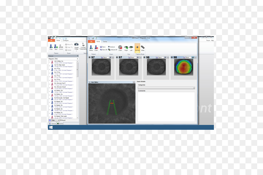 Topografía，La Topografía De La Córnea PNG