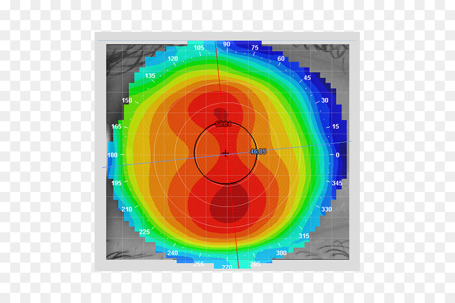 La Topografía De La Córnea，Córnea PNG