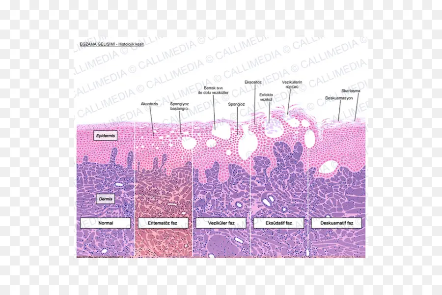 Histología，Queratinocito PNG