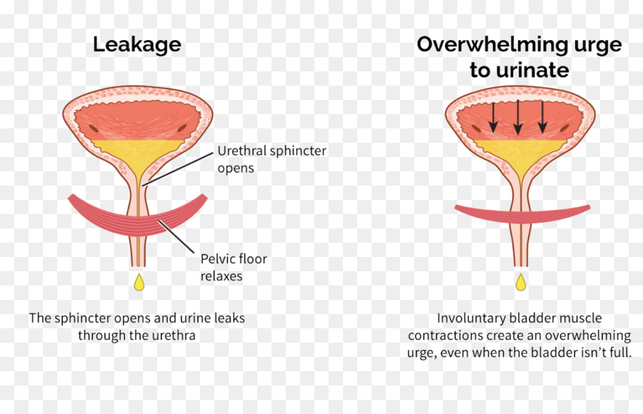 La Vejiga Hiperactiva，La Vejiga Urinaria PNG