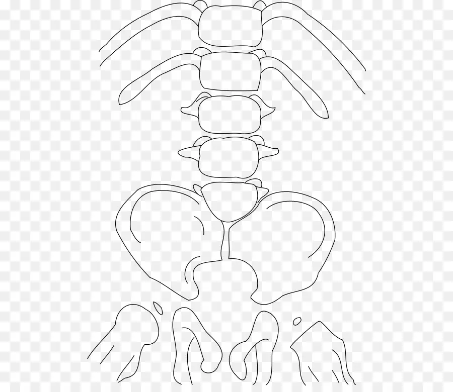 Caudal De Regresión Síndrome De，El Síndrome De PNG