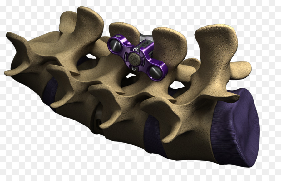 Ligamento Interpinio，La Columna Vertebral PNG