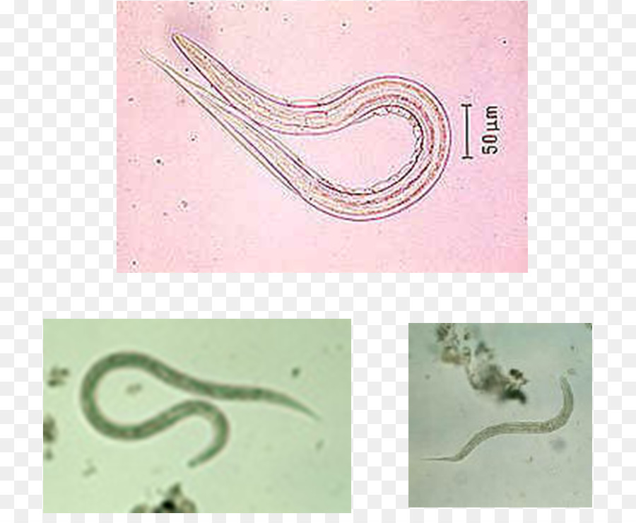 Ancylostoma Ancyclostoma，Anquilostomiasis PNG