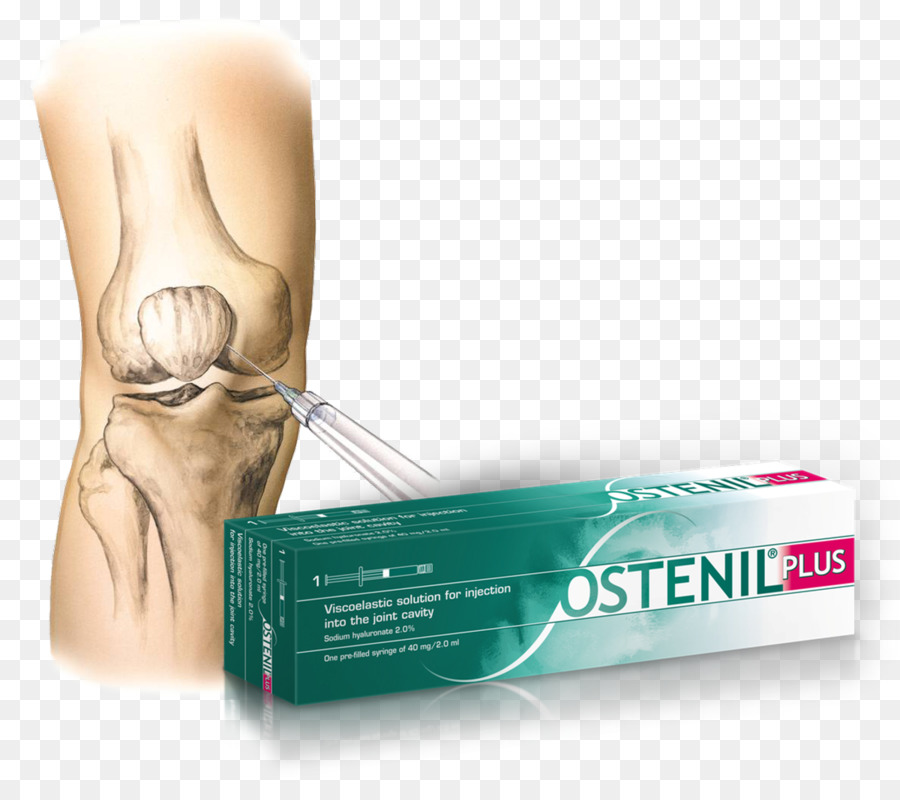 El ácido Hialurónico，La Osteoartritis PNG