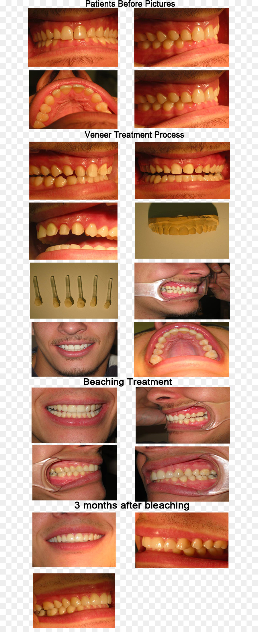 Chapa，Dentista PNG