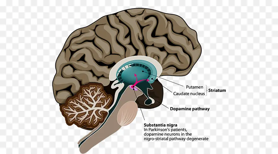 La Enfermedad De Parkinson，La Enfermedad PNG