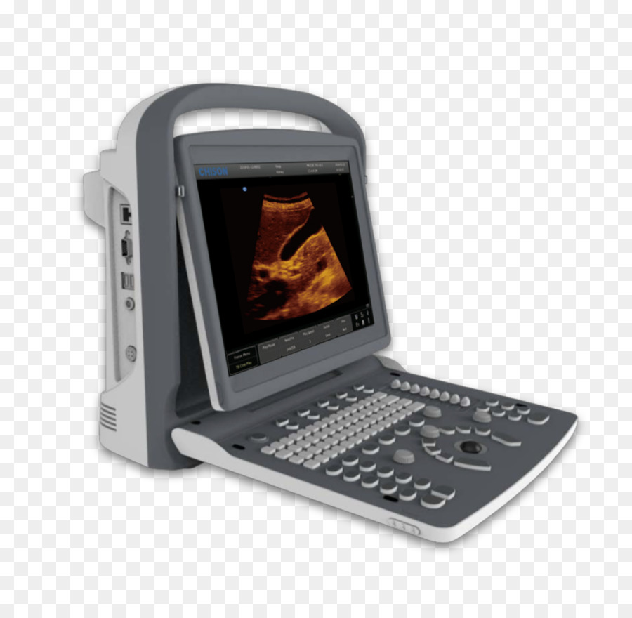 Máquina De Ultrasonido，Pantalla PNG