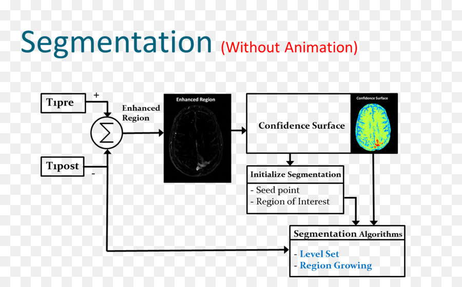 La Segmentación De La Imagen，Tumor Cerebral PNG