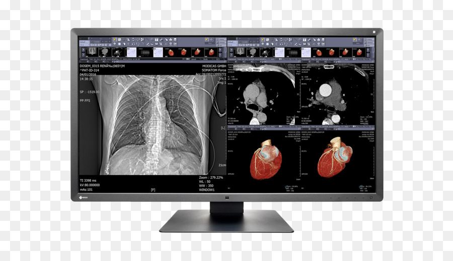 Monitor De Imágenes Médicas，Médico PNG