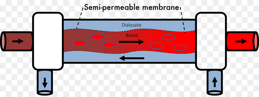 La Hemodiálisis，La Diálisis PNG