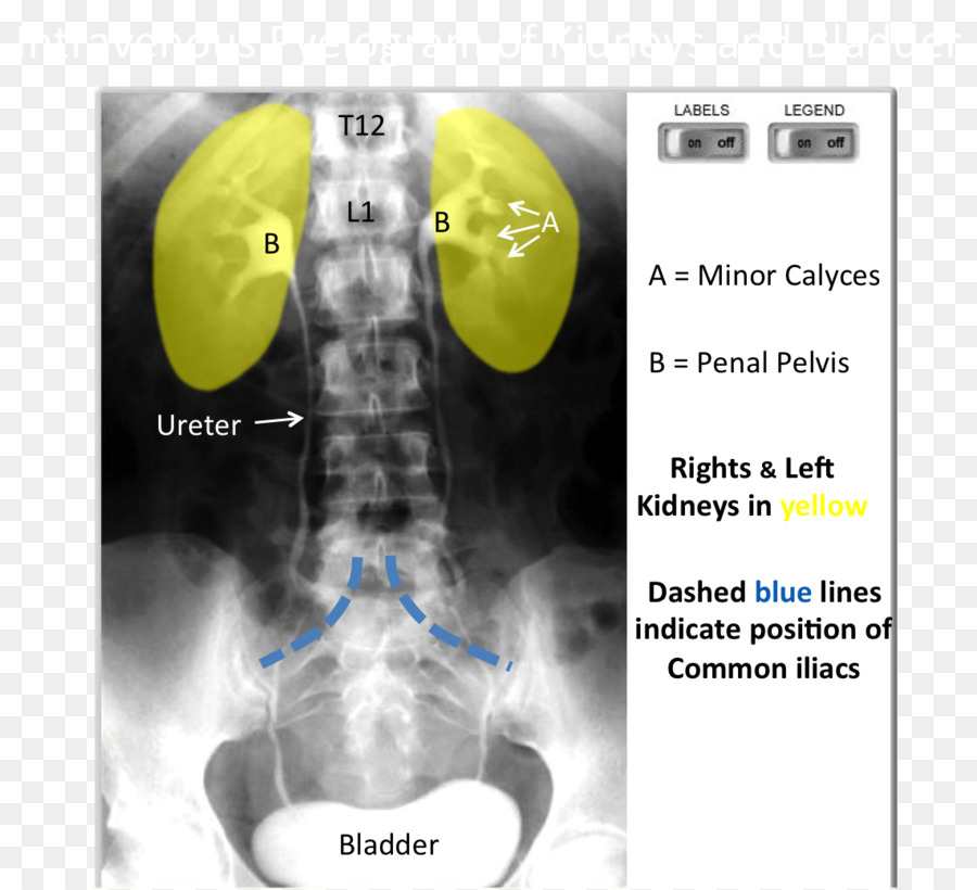 Imágenes Médicas，Radiología PNG