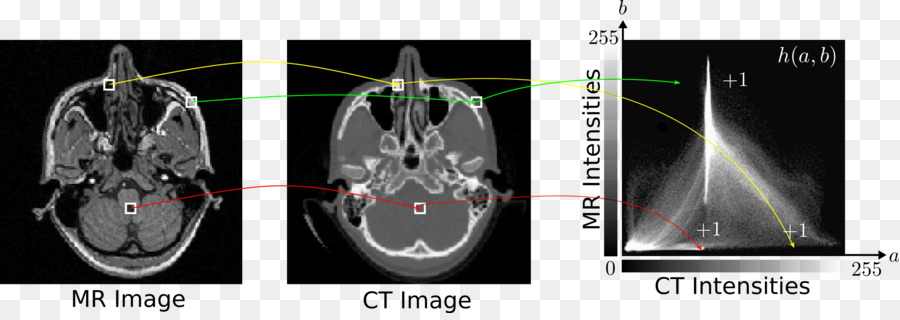 Imagenes Medicas，Radiología PNG