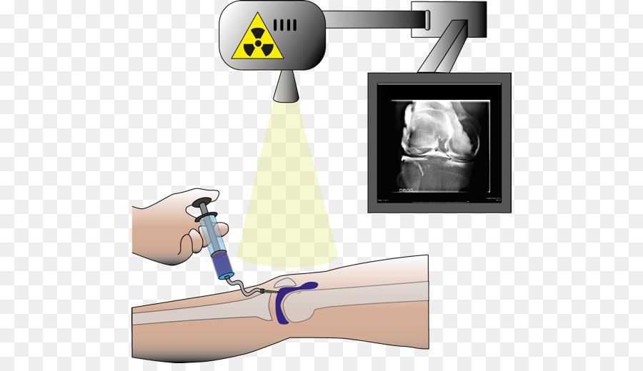 Inyección，Radiología PNG