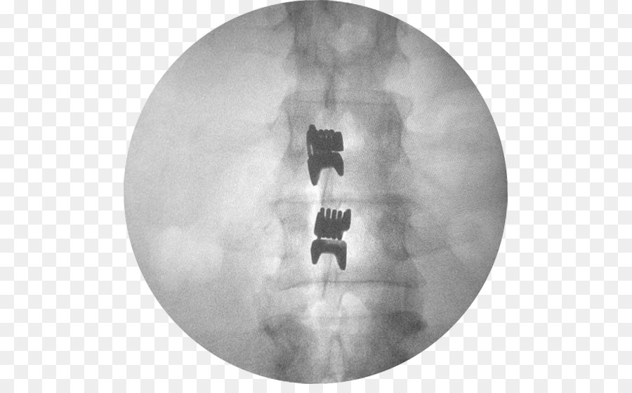 Interspinales Músculos，La Columna Vertebral PNG