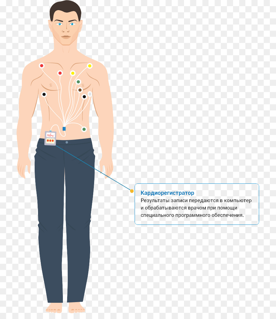 Monitor Holter，La Hipertensión PNG