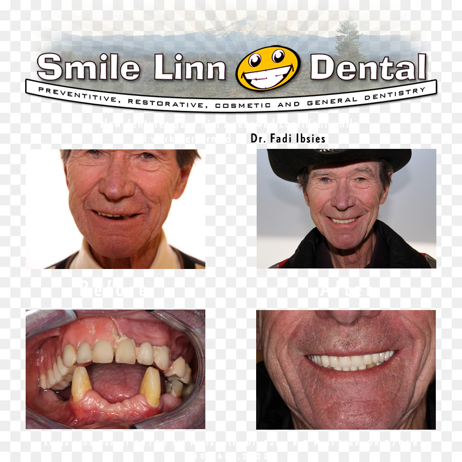 La Sonrisa De Linn Dental Ibsies Fadi B Dmd，Dentista PNG