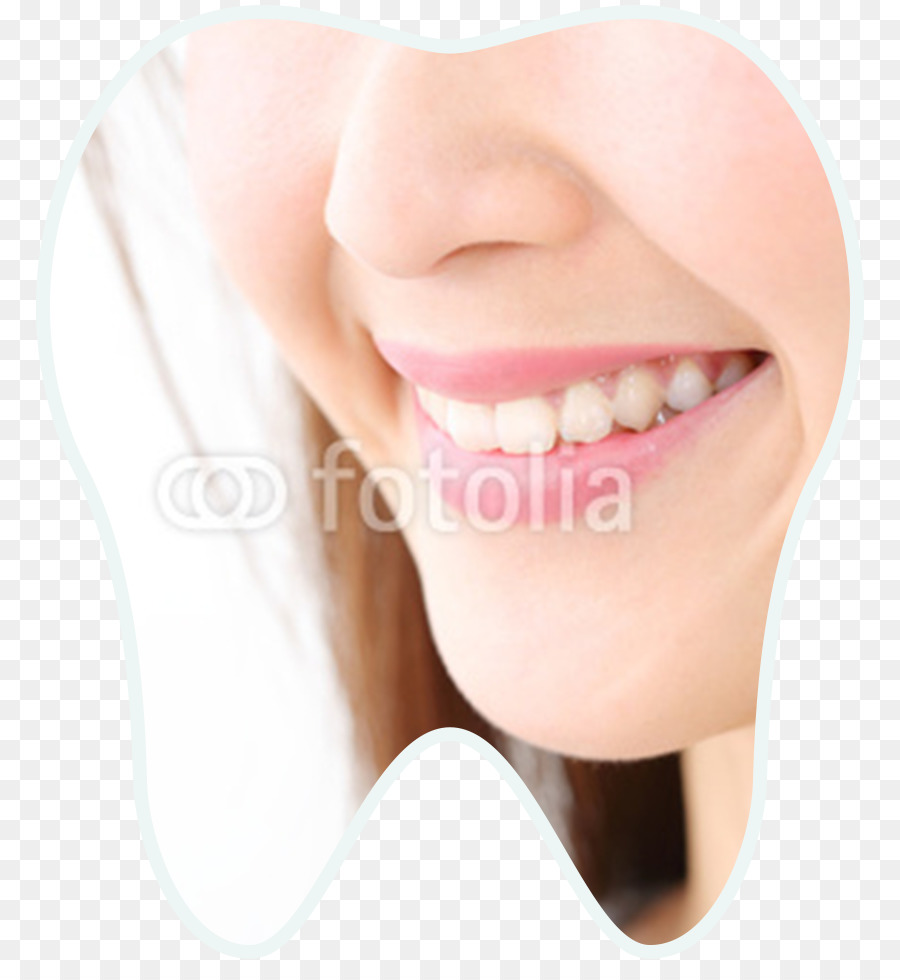 Sonrisa，La Mejilla PNG