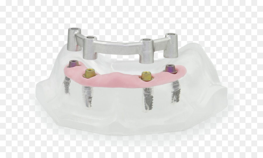 Odontología，Odontología Cad Cam PNG