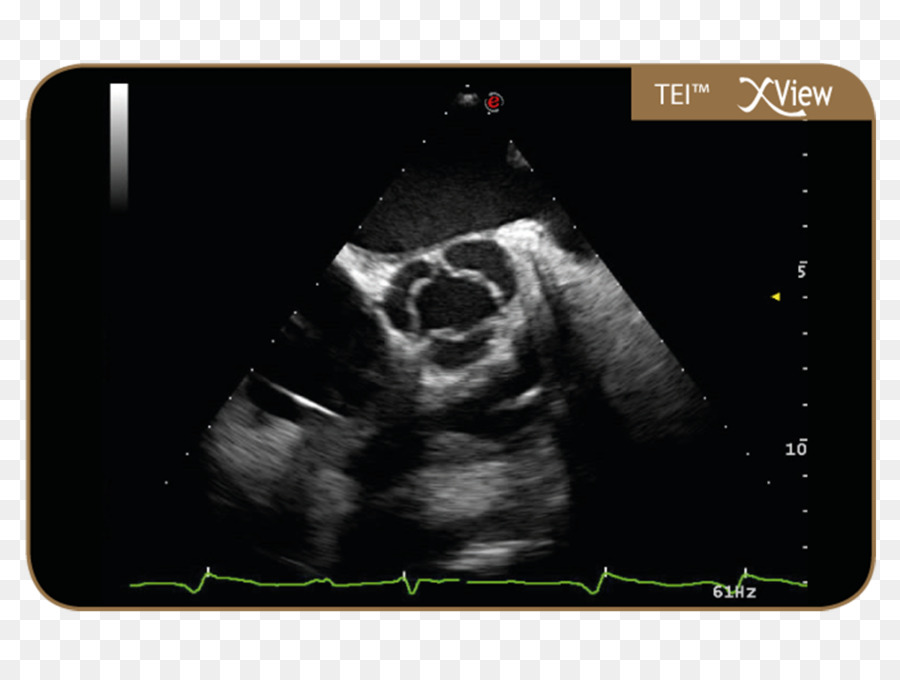 Radiología，Esqueleto De La Encuesta PNG