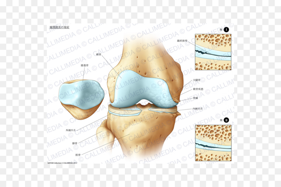 Tibia，Dolor De Rodilla PNG