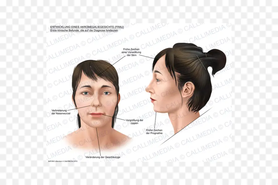 Diagrama De Rasgos Faciales，Rostro PNG