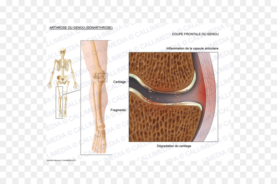 Hombro，Ligamento Colateral Fibular PNG