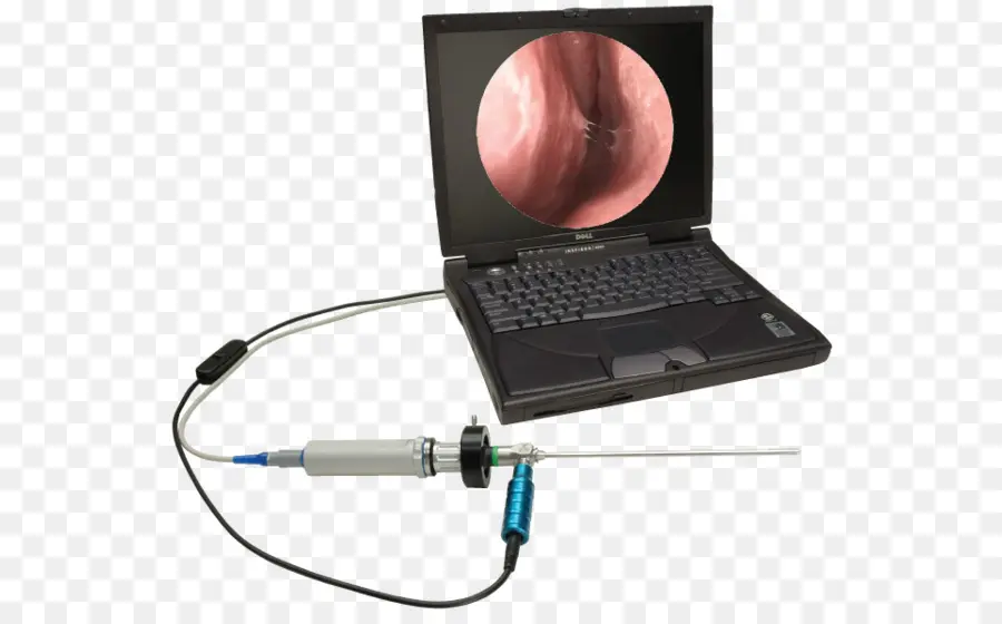 La Endoscopia，Otorrinolaringología PNG