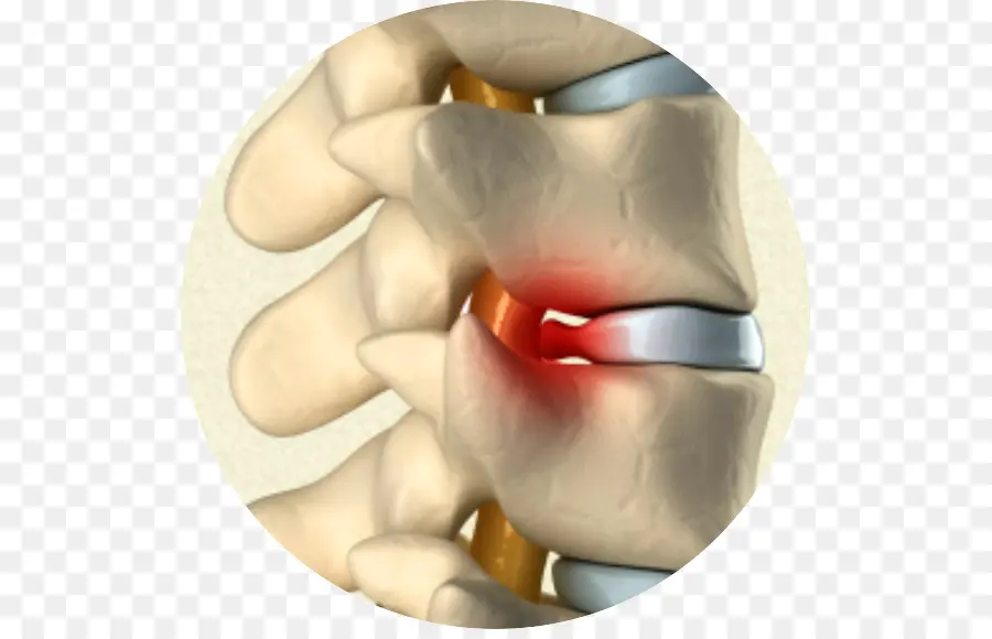 Columna Vertebral，Vértebras PNG