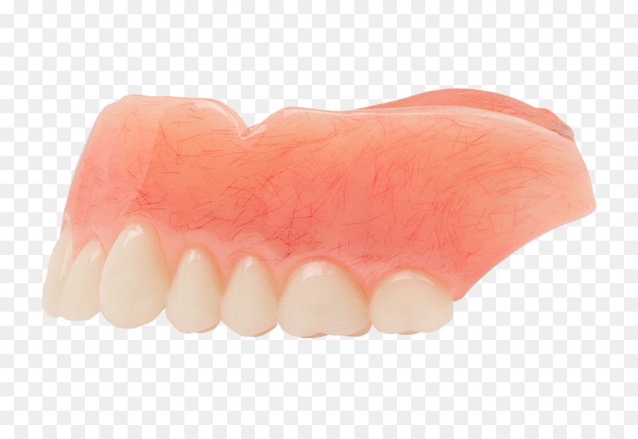 Diente，Prótesis Dentales PNG