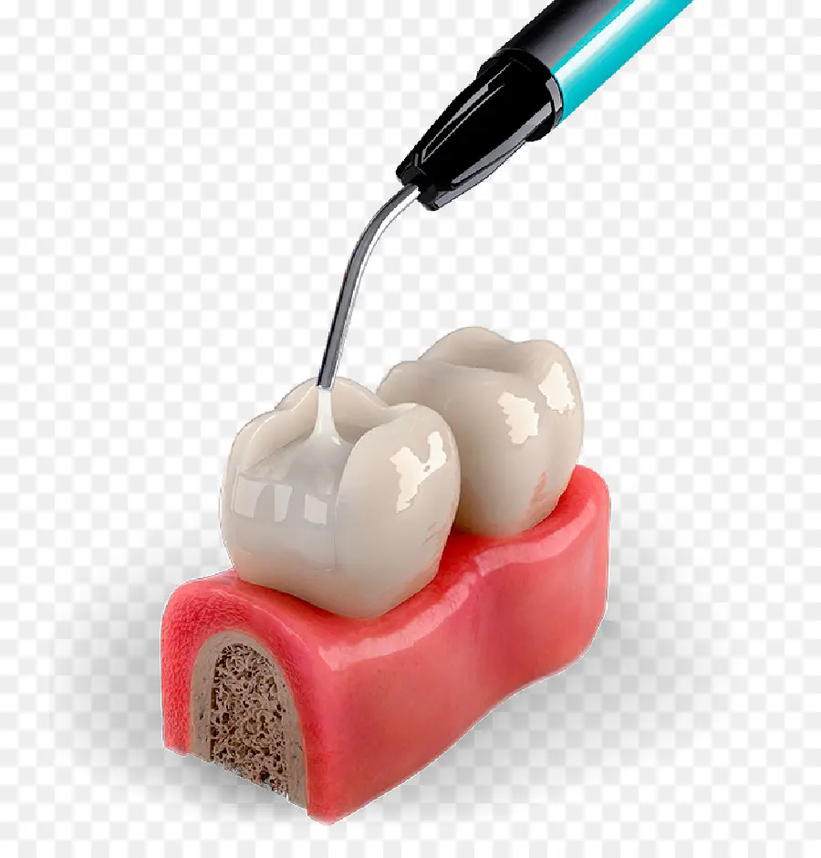 Diente，Odontología PNG