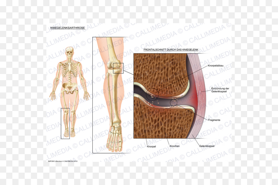 Hombro，Anatomía PNG