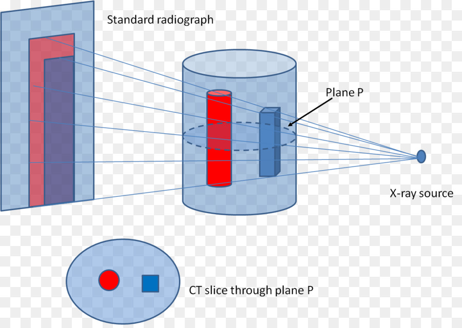 Xray Microtomografía，Tomografía Computarizada PNG