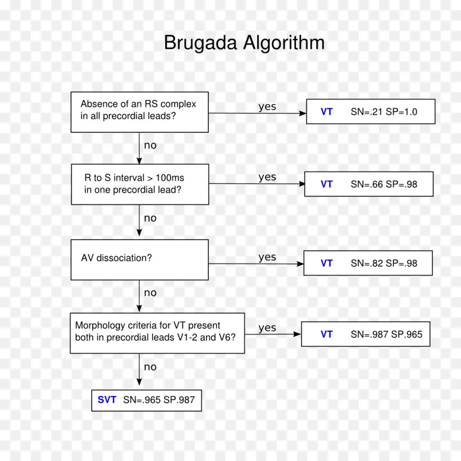 Síndrome De Brugada，Electrocardiografía PNG