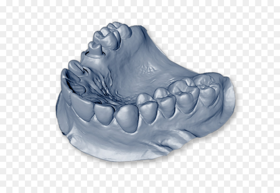 Odontología，Implante Dental PNG