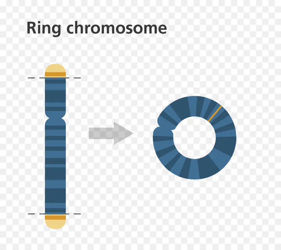 Cromosoma De Anillo，Anormalidad Cromosómica PNG