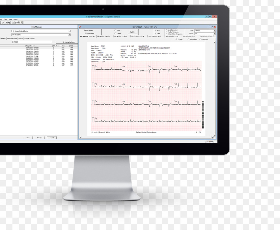 Electrocardiografía，Gestión PNG