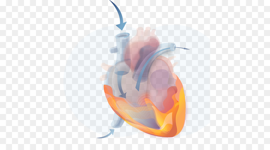 La Enfermedad Cardiovascular，La Enfermedad PNG