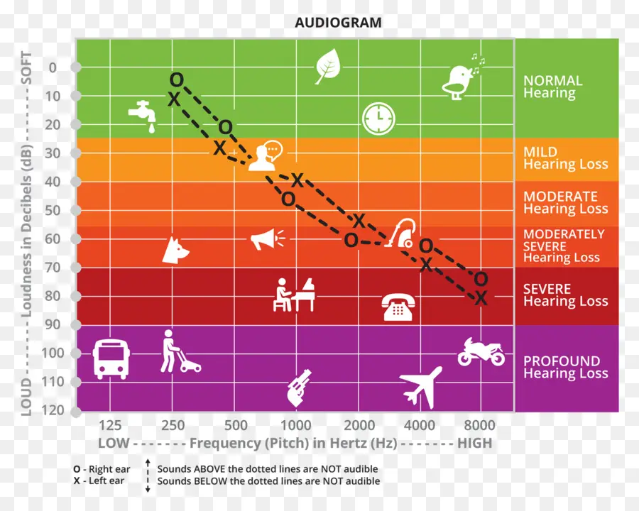 Audiograma，Audiencia PNG