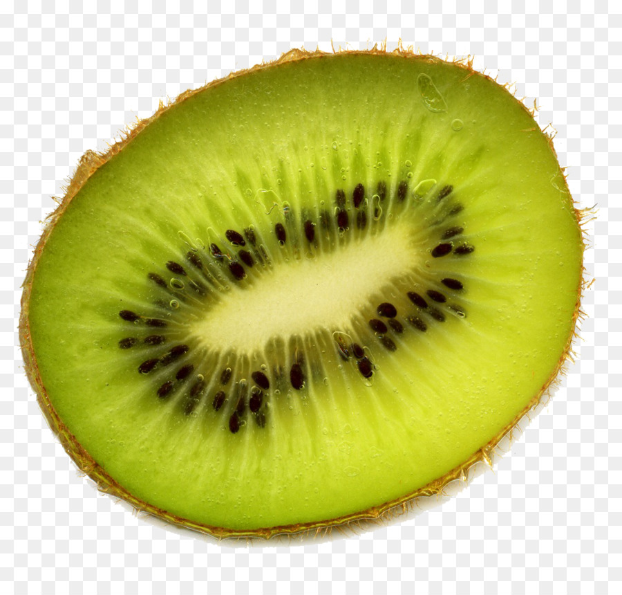 Kiwi，Conos De Helado PNG