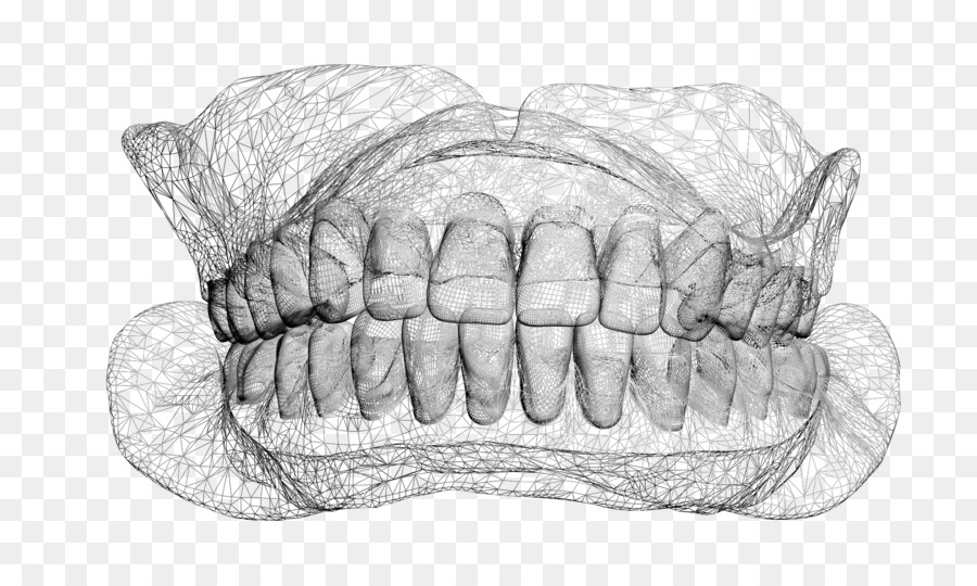 Sobredentaduras，Prótesis Dentales PNG