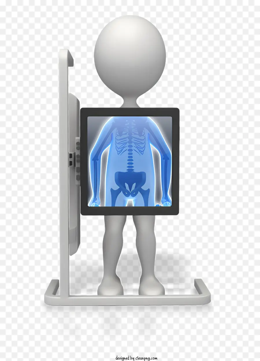 Figura De Palo，Xray Imaging PNG