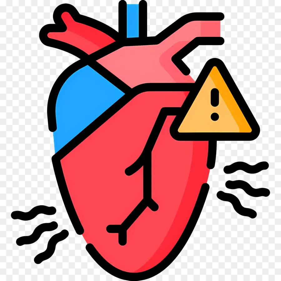 Infarto De Miocardio，Corazón Con Advertencia PNG