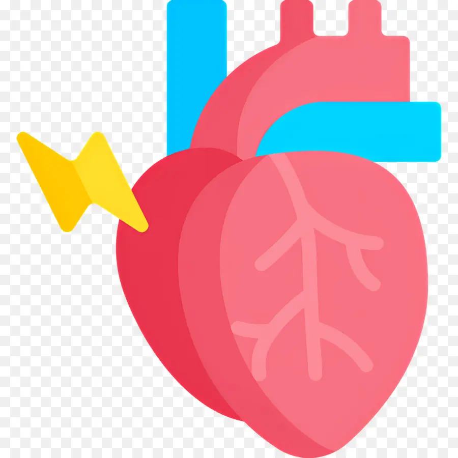 Infarto De Miocardio，Ilustración Del Corazón PNG