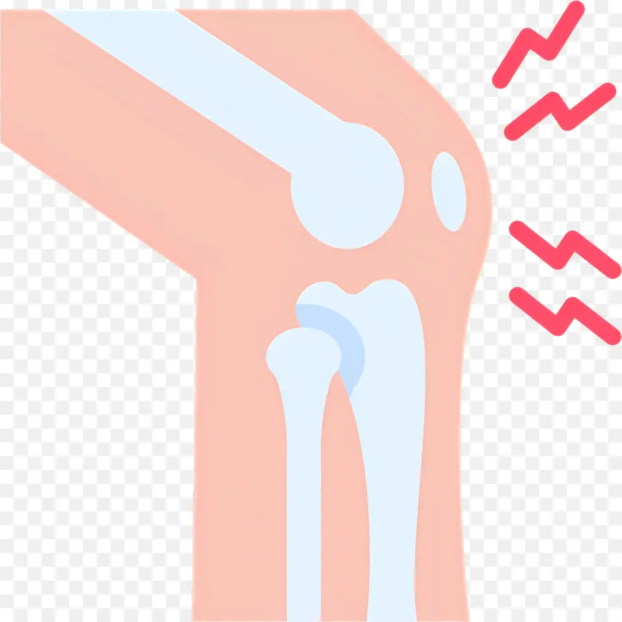 Dolor De Rodilla，Ilustración De La Articulación De La Rodilla PNG