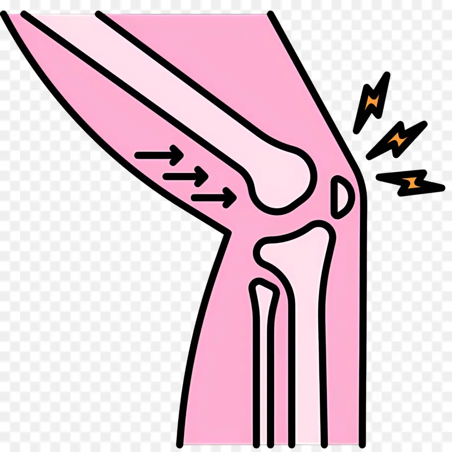 Dolor De Rodilla，Rodilla PNG